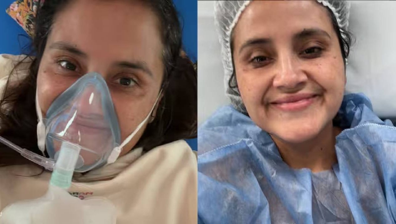 /pamela-leiva-mostro-resultado-de-importante-cirugia-estetica